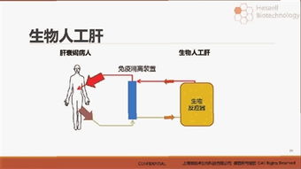 人工肝醫保 人工肝治療費用